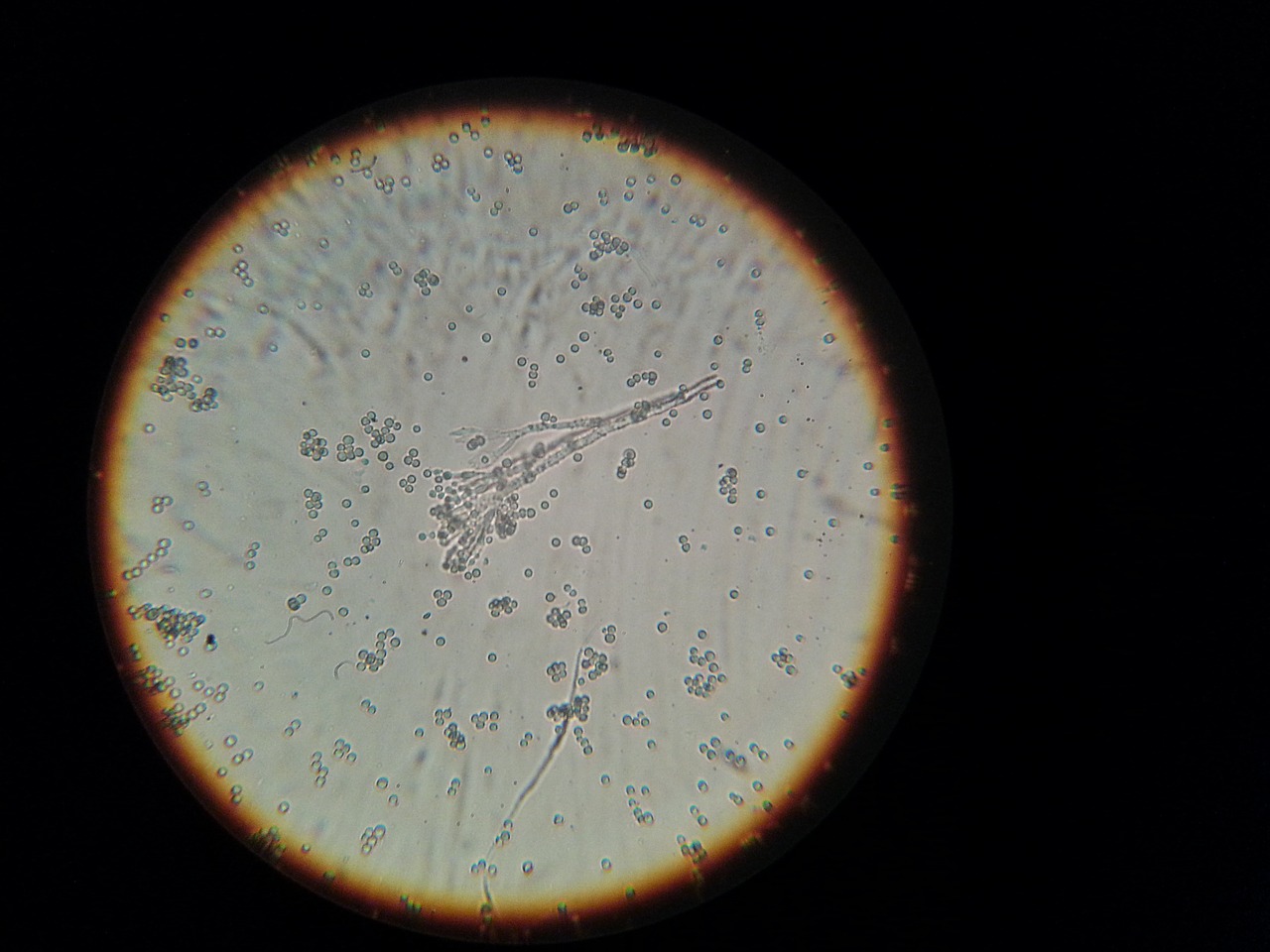 Bakterijos, Mikroskopas, Mikroskopinis Vaizdas, Nemokamos Nuotraukos,  Nemokama Licenzija