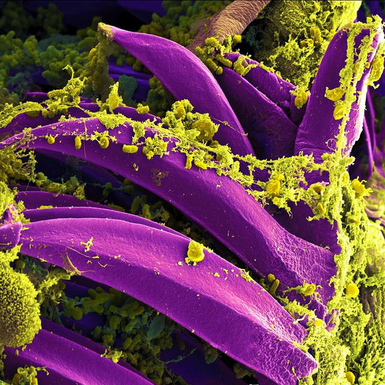 Bakterijos,  Elektroninis Mikroskopas,  Dažytos Violetinės Spalvos,  Buboninė Maras,  Y Pestis,  Bakterija,  Patogeną,  Mokslas,  Mikrobiologija,  Epidemija