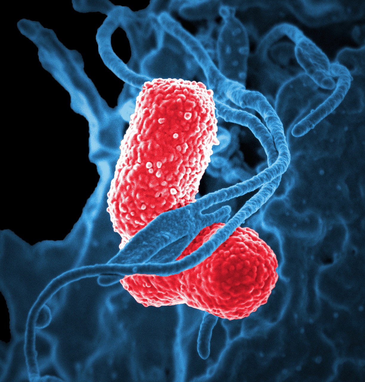 Bakterijos, Elektroninis Mikroskopas, Klebsiella Pneumoniae, Raudona Spalva, Plaučių Uždegimas, Bakterija, Patogeną, Mokslas, Mikrobiologija, Epidemija