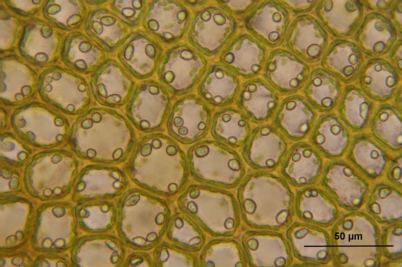 Bazzania Tricrenata, Mikroskopinis, Ląstelės, Biologija, Makro, Mokslas, Augalas, Botanika, Nemokamos Nuotraukos,  Nemokama Licenzija