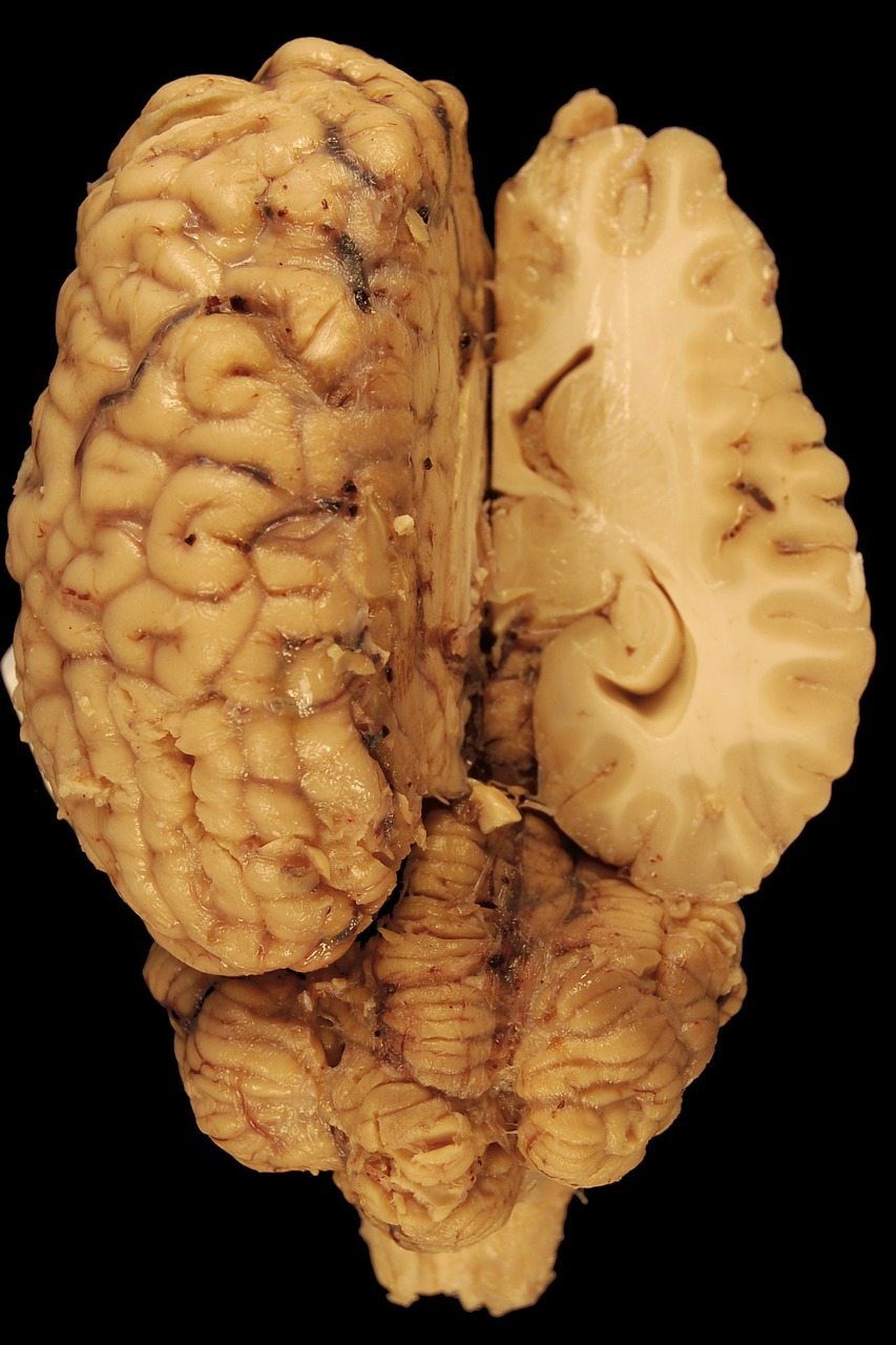 Smegenys, Anatomija, Arklys, Biologija, Nugaros Dalis, Kūnas, Veterinarinė Medicina, Galvos Smegenys, Smegenėlė, Pusrutulis