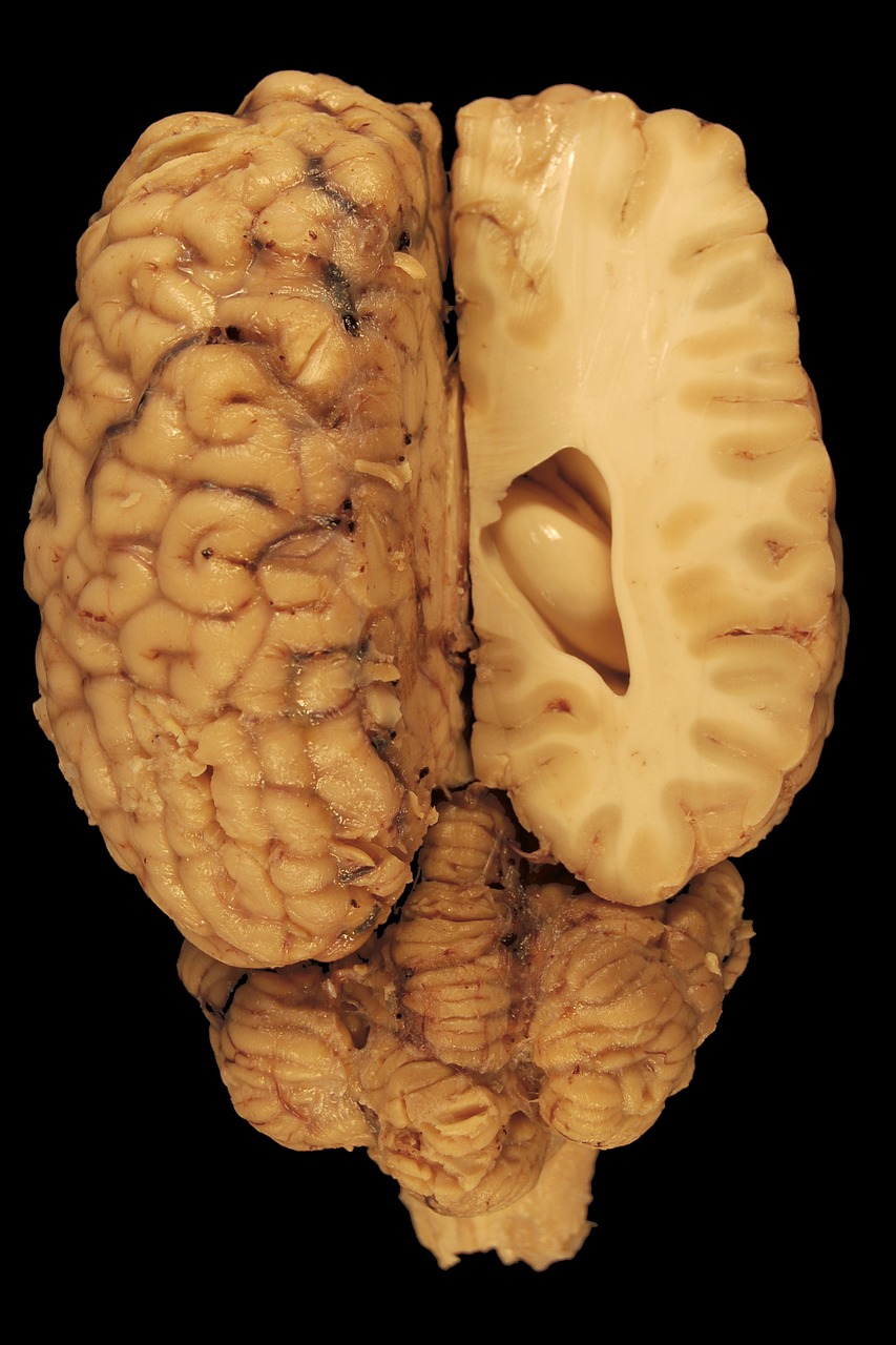 Smegenys, Anatomija, Akys, Paerparat, Arklys, Biologija, Nugaros Dalis, Kūnas, Veterinarinė Medicina, Galvos Smegenys