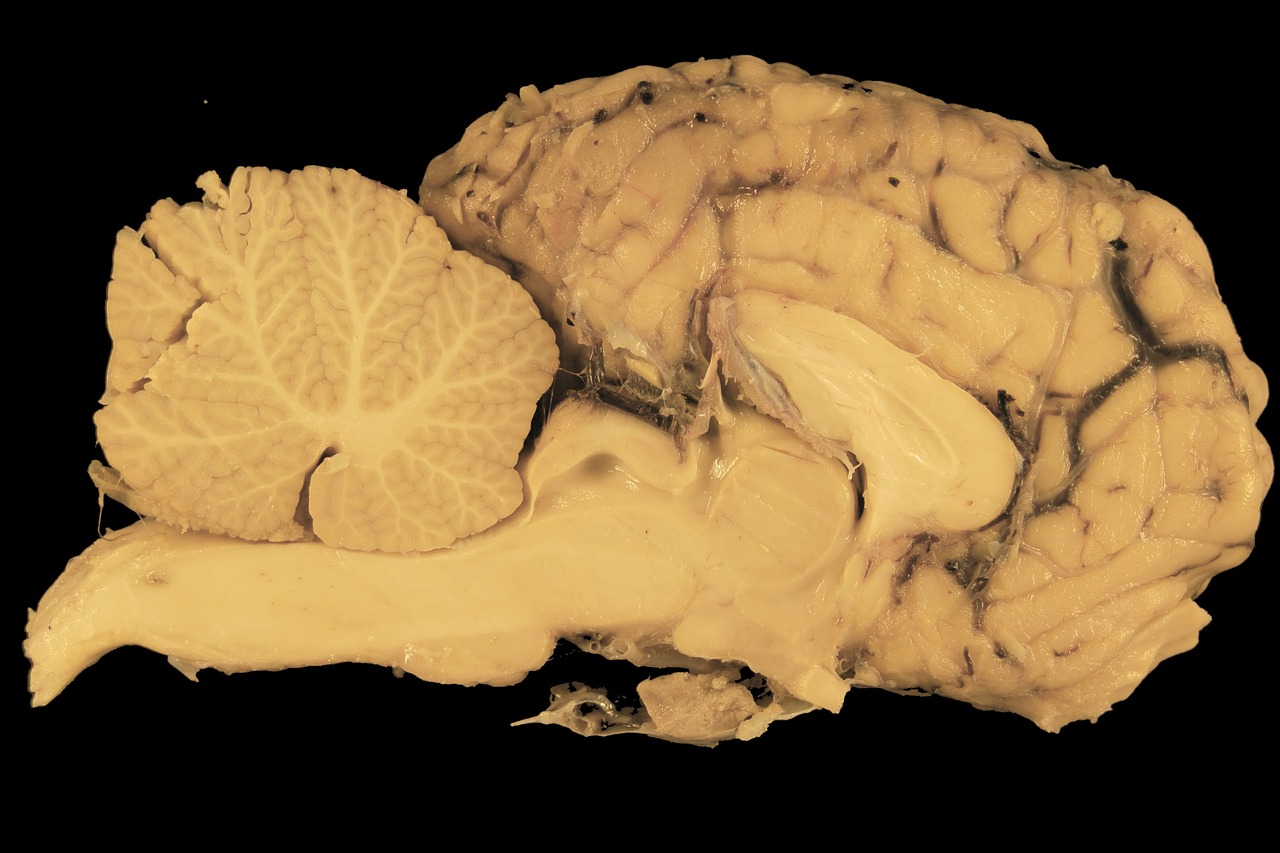 Smegenys, Arklys, Skyrius, Anatomija, Paruošimas, Smegenėlė, Galvos Smegenys, Smegenų Kamienas, Mokslas, Biologija