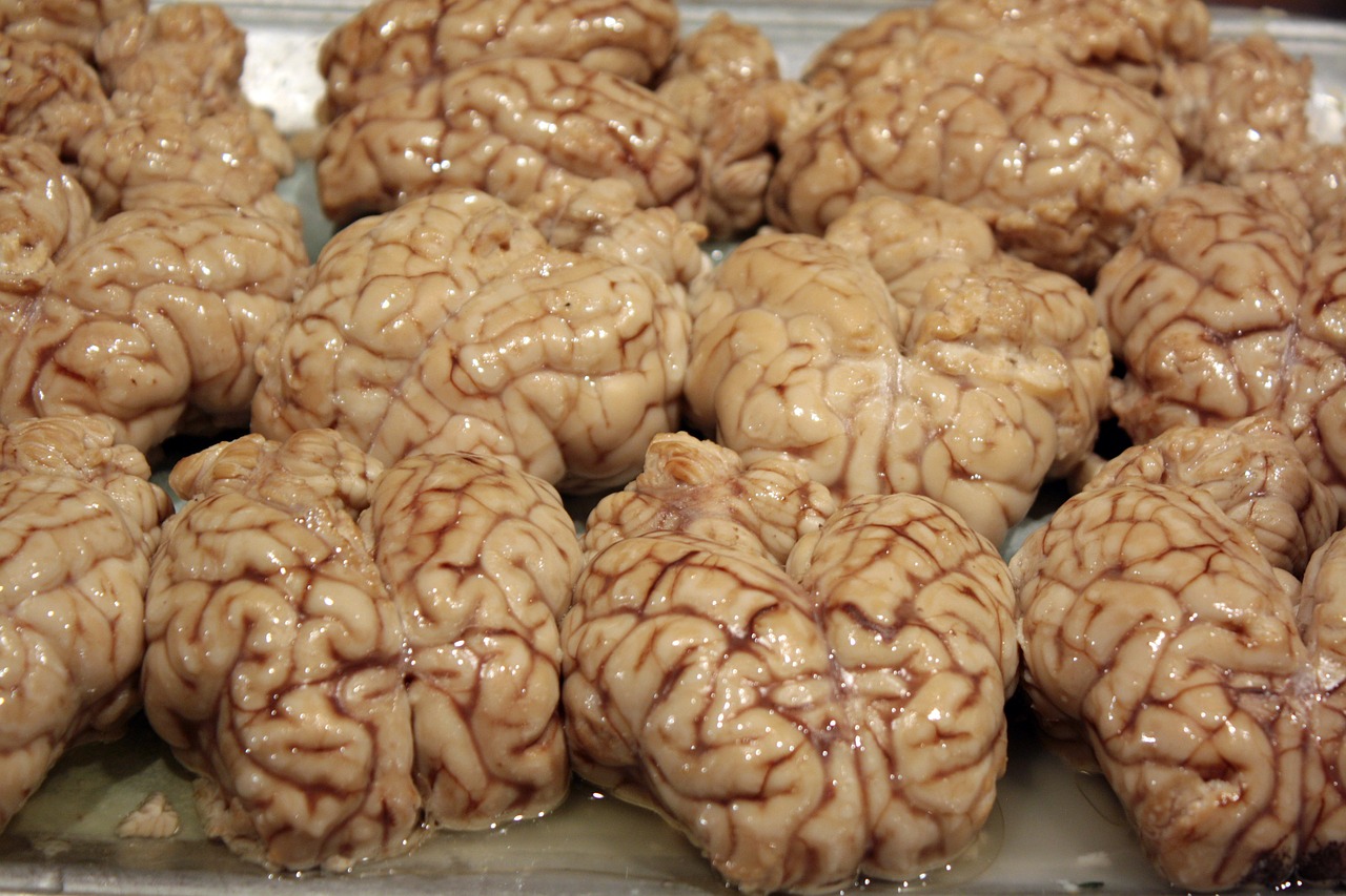 Smegenys, Priešiški, Organas, Neuronas, Protas, Mąstymas, Maistas Mintims, Intelektas, Smegenų Audra, Idėja