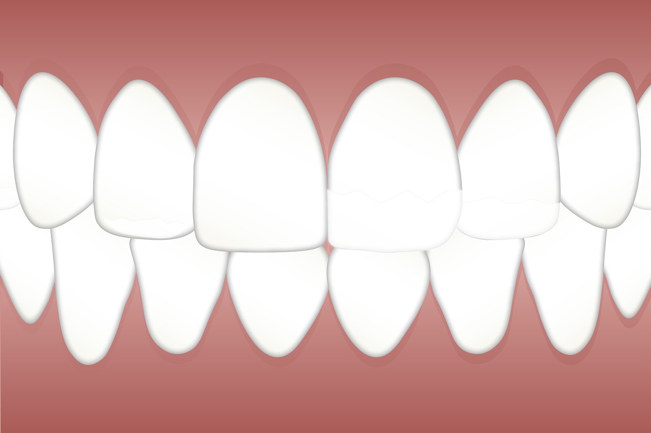 Dantų,  Fluorozė,  Margi,  Dantys,  Sveikata,  Odontologas,  Odontologija,  Dantis,  Higiena,  Žodžiu