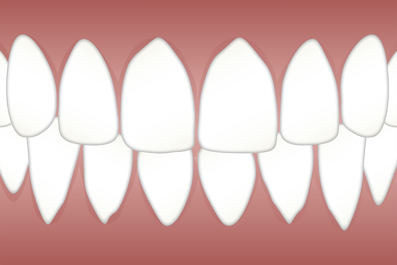 Dantų,  Periodonto,  Liga,  Baltos Spalvos,  Vieta,  Liežuvis,  Lopai,  Odontologas,  Higiena,  Dantys