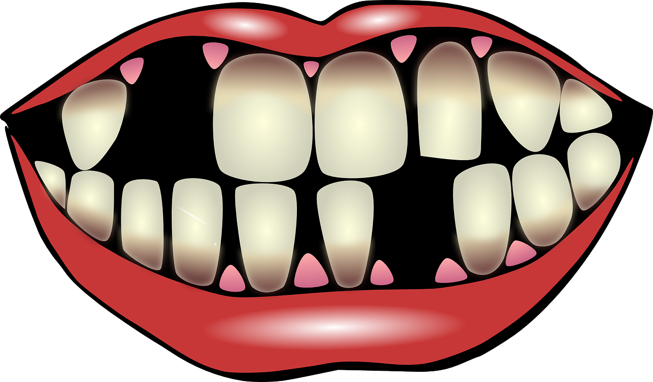 Dantų Higiena, Dantų Priežiūra, Nukristi Iš Dantų, Dantų Sveikata, Burna, Dantys, Dantis, Nemokama Vektorinė Grafika, Nemokamos Nuotraukos,  Nemokama Licenzija
