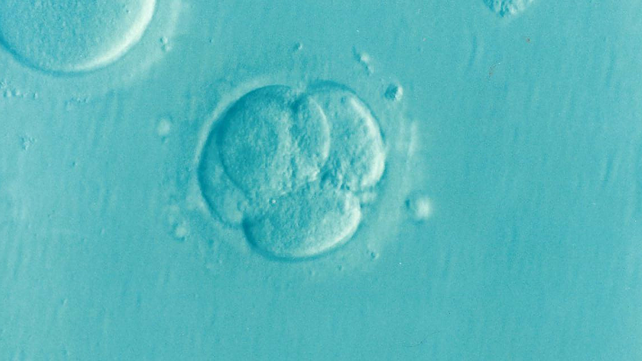 Embrionas, Ivf, Icsi, Nevaisingumas, Vaisingumas, Nemokamos Nuotraukos,  Nemokama Licenzija