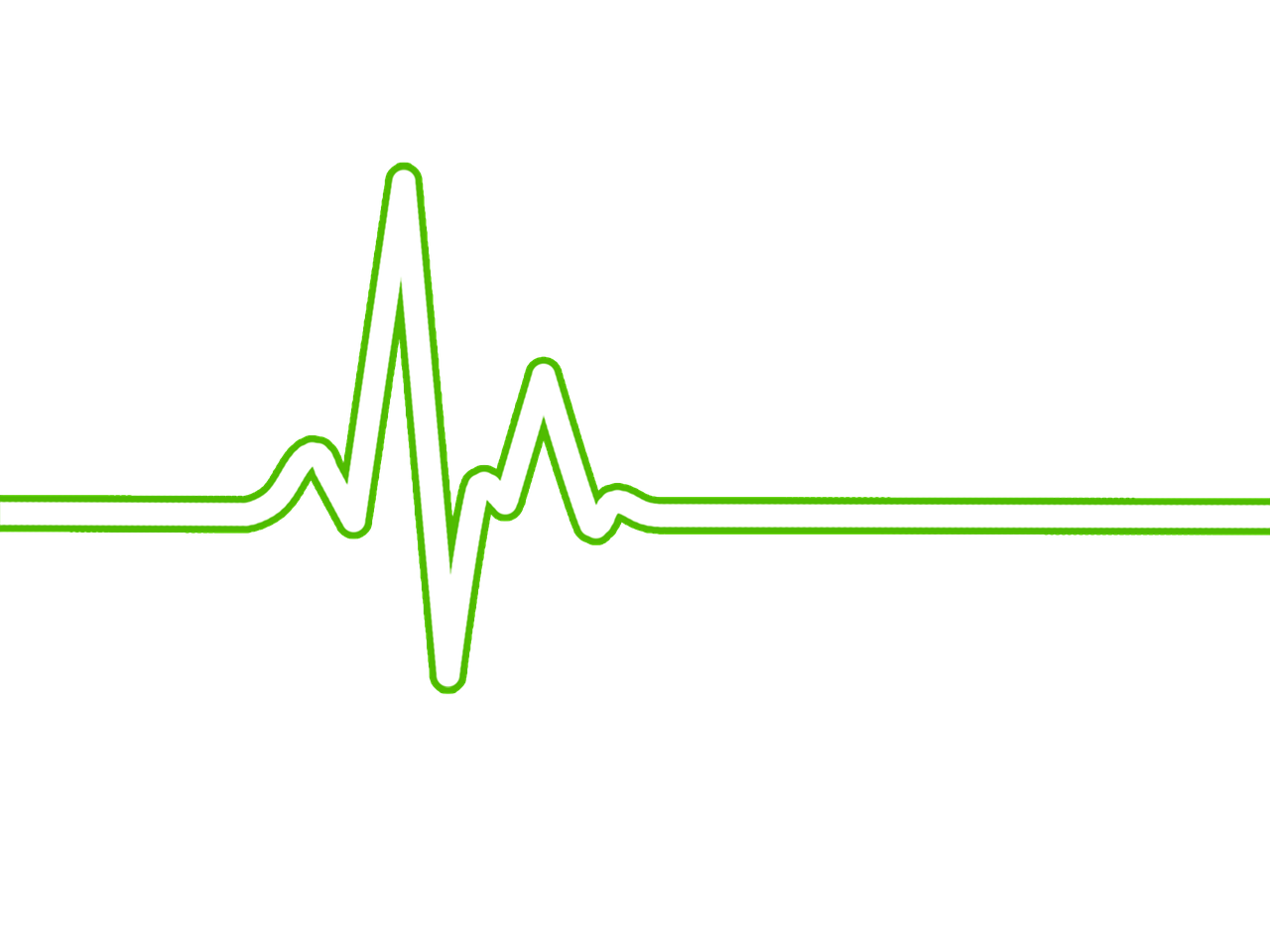 Širdies Ritmas, Bpm, Ecg, Ekg, Elektrokardiogramma, Ecg Bangos, Stebėti, Širdis, Sveikata, Gyvenimas