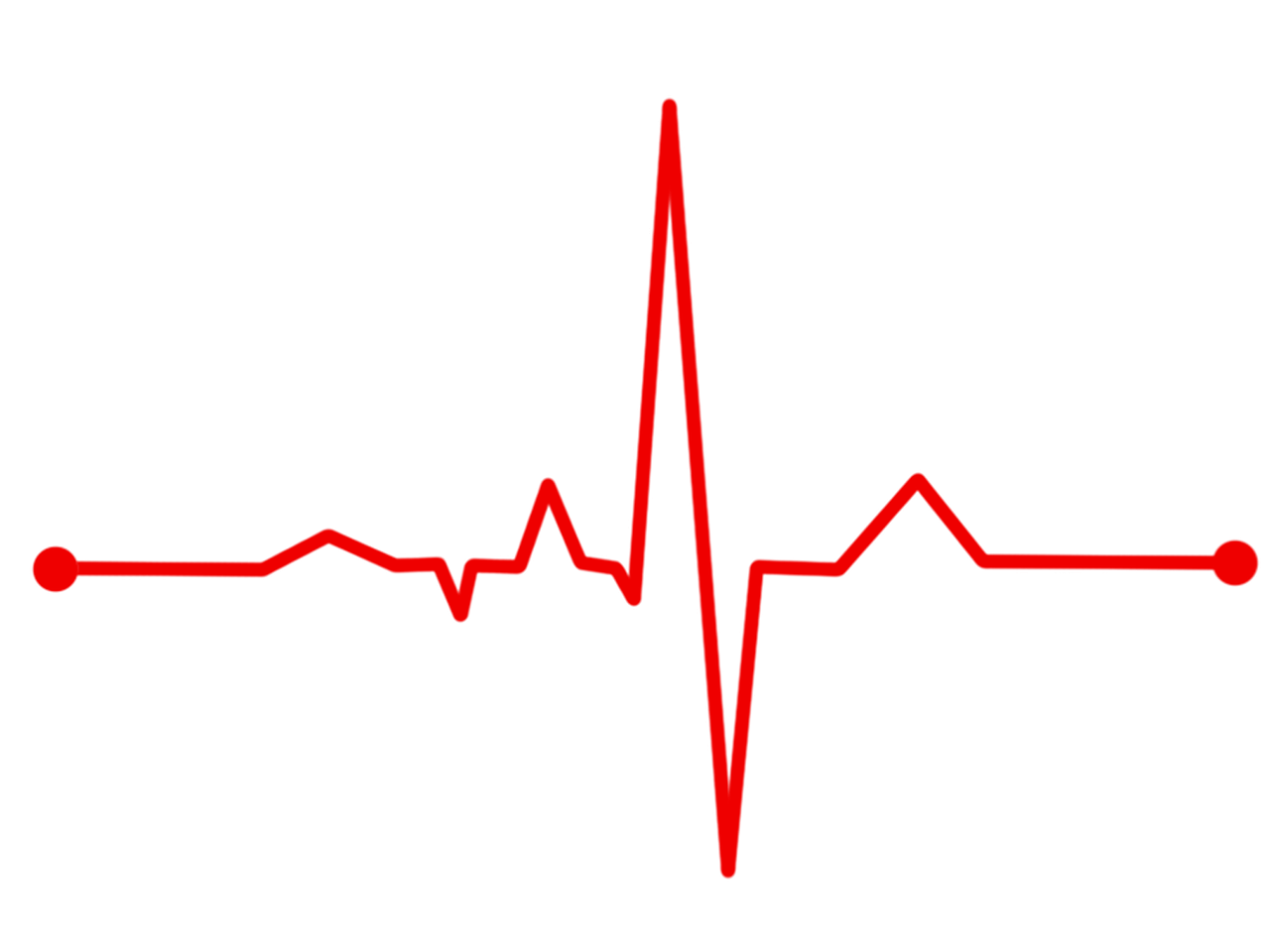 Širdies Ritmas, Bpm, Ecg, Ekg, Elektrokardiogramma, Ecg Bangos, Stebėti, Širdis, Sveikata, Gyvenimas