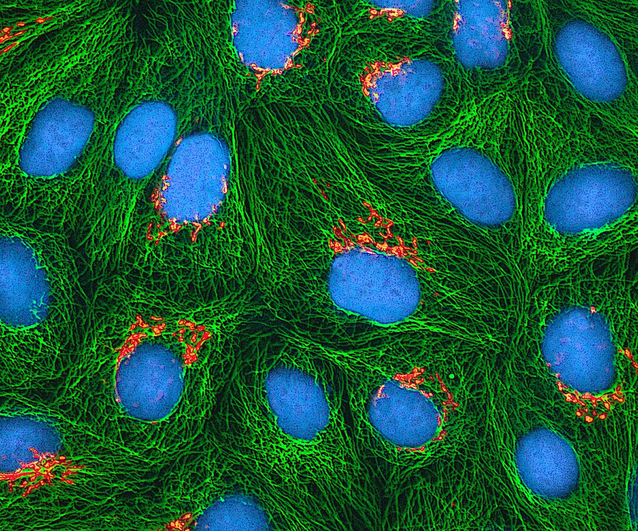 Hela Ląstelės, Kultivuotas, Elektroninis Mikroskopas, Dažytos, Fluorescencinis Baltymas, Mikrotubulės, Nemokamos Nuotraukos,  Nemokama Licenzija