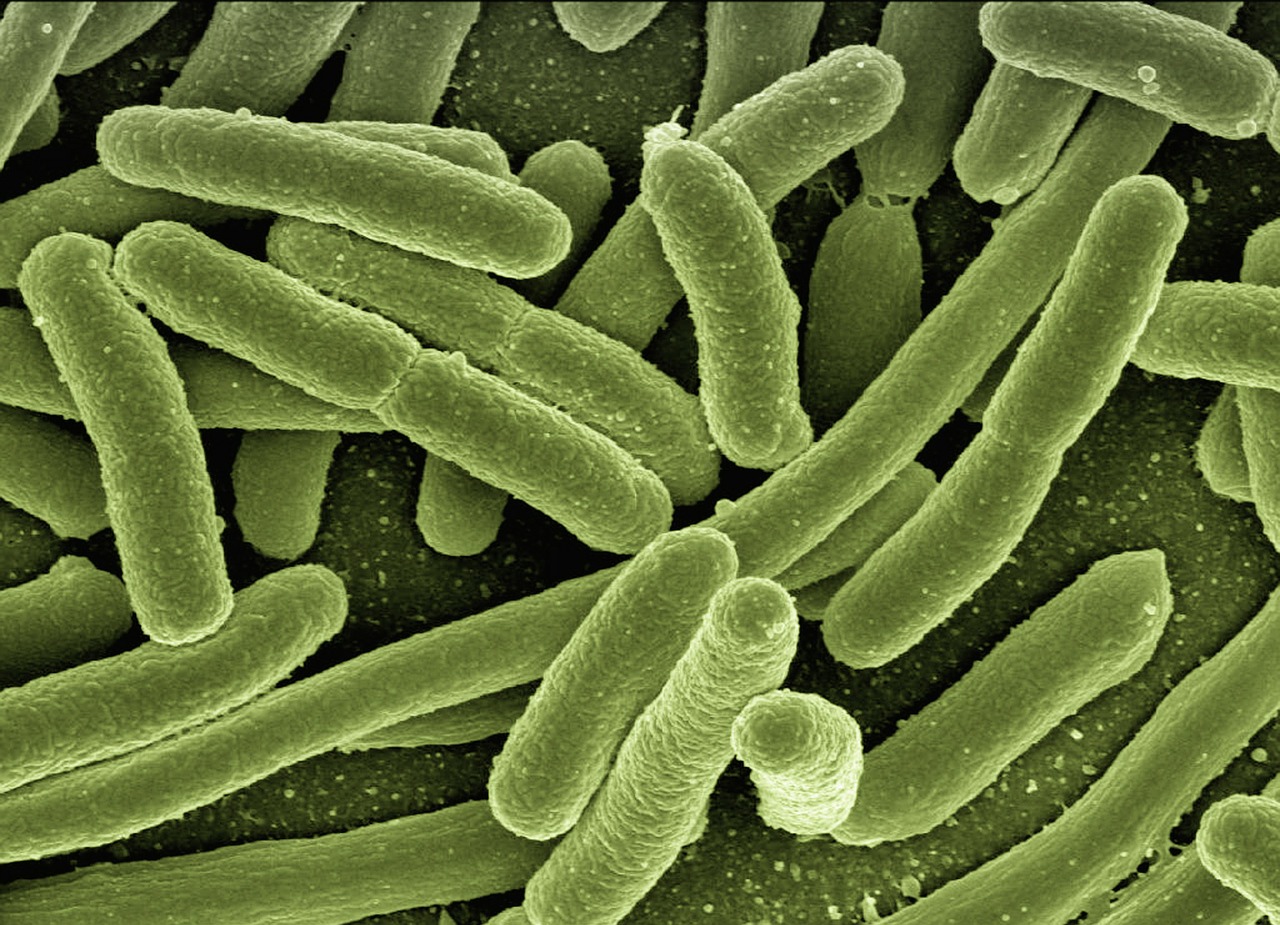 Koli Bakterijos, Escherichia Coli, Bakterijos, Liga, Patogenai, Mikroskopija, Elektronų Mikroskopija, Elektroninis Mikroskopas, Didinimas, Mokslas