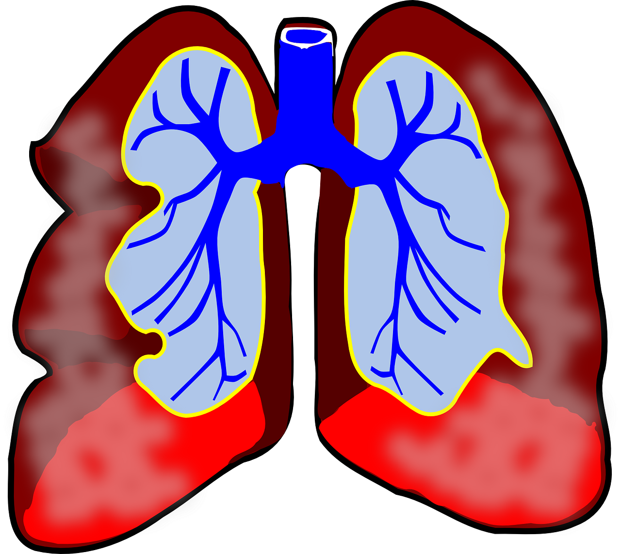Plaučiai, Žmogus, Diagrama, Kvėpavimo Takai, Biologija, Kvėpavimas, Mokslas, Sistema, Oras, Sveikata