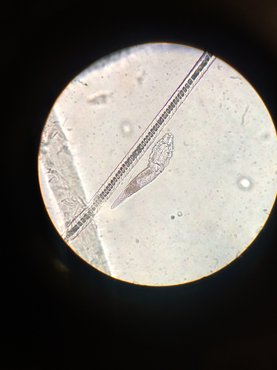 Mikroskopas, Erkės, Demodex, Šuo, Parazitas, Nemokamos Nuotraukos,  Nemokama Licenzija