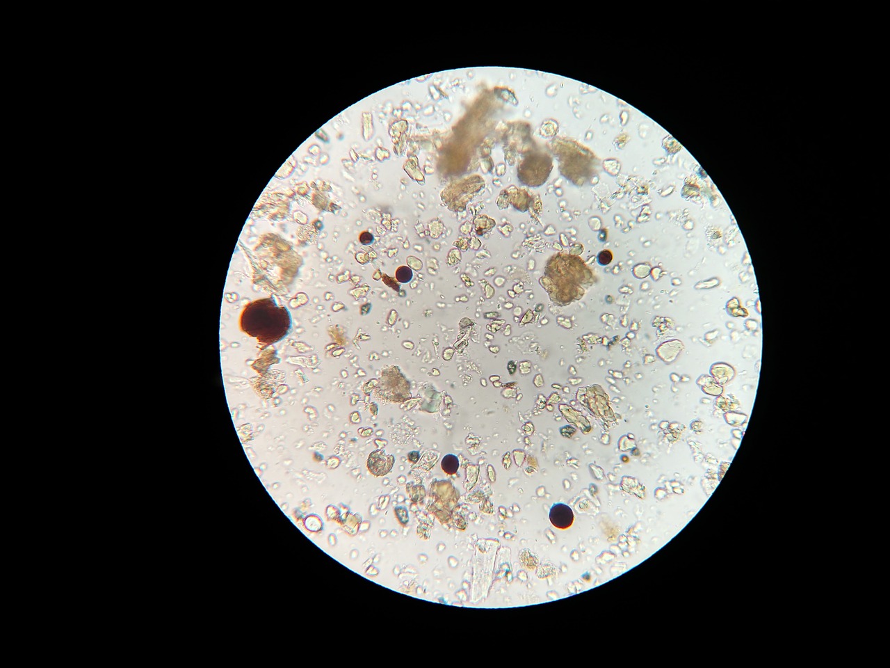 Dirvožemio Mikrobai, Mikroskopas, Dirvožemio Pavyzdys, Nemokamos Nuotraukos,  Nemokama Licenzija