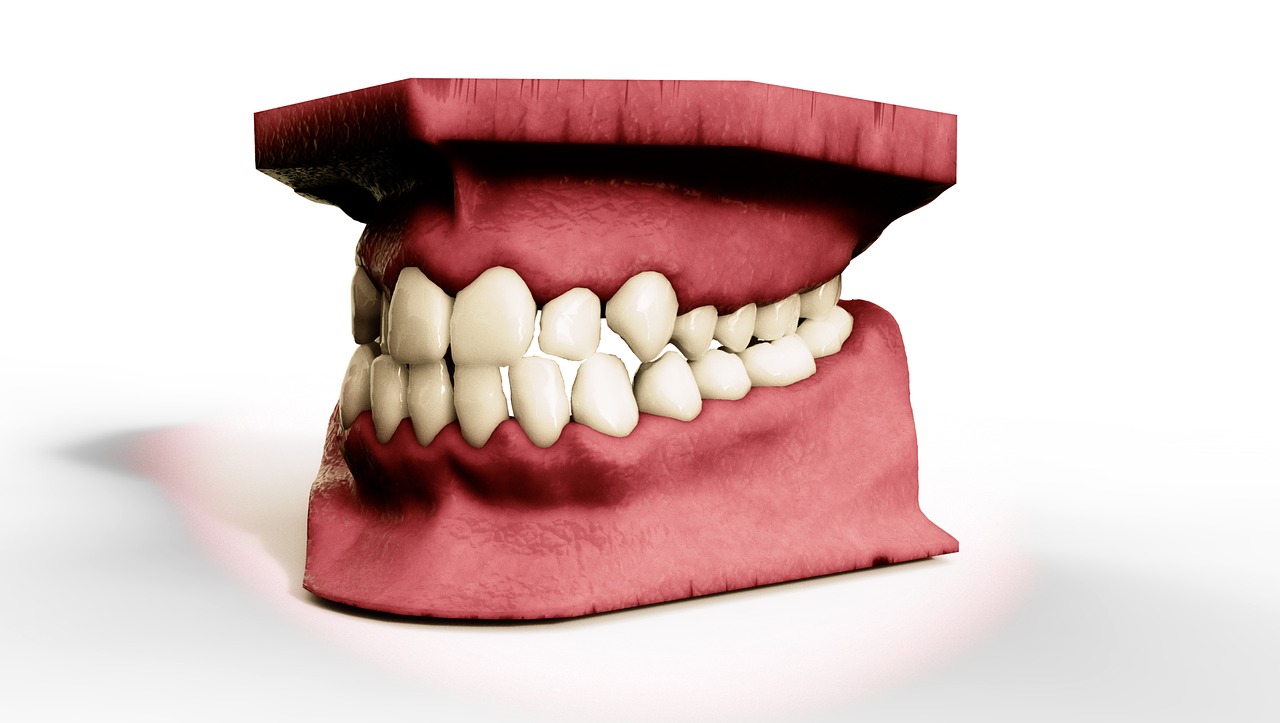 Dantys, Žandikaulis, 3D Modelis, Ortodontija, Odontologija, Nemokamos Nuotraukos,  Nemokama Licenzija