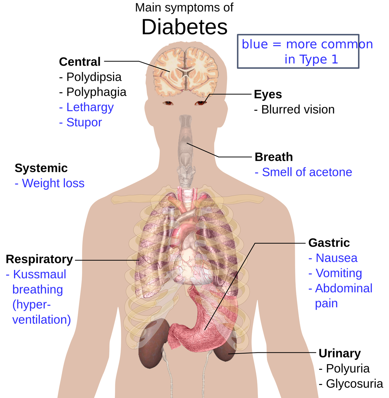 Žmogaus Kūno Anatomija, Didelė Nuotrauka, Svarbūs Diabeto Simptomai, Diagramos, Smegenys, Akys, Kvėpavimas, Trachėjos, Kvėpavimas, Plaučiai