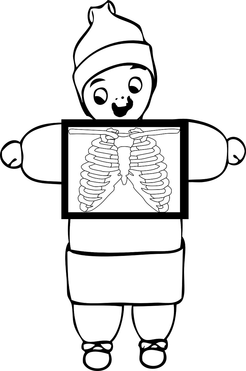 Xray, Krūtinė, Krūtinės Ląstos Juosta, Liemuo, Išlikti Gluosniai Girlianda, Balta, Kūnas, Medicinos, Skeletas, Bobble