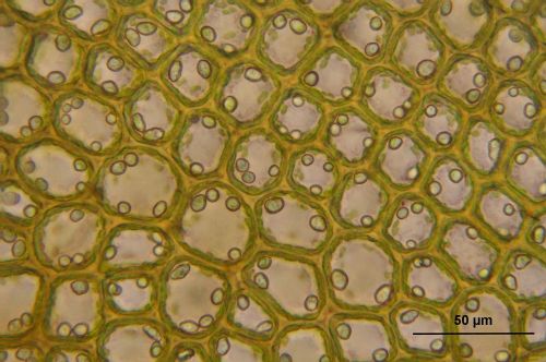 Bazzania Tricrenata, Mikroskopinis, Ląstelės, Biologija, Makro, Mokslas, Augalas, Botanika