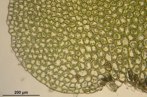 Bazzania Trilobata, Mikroskopinis, Ląstelės, Biologija, Makro, Mokslas, Augalas, Botanika