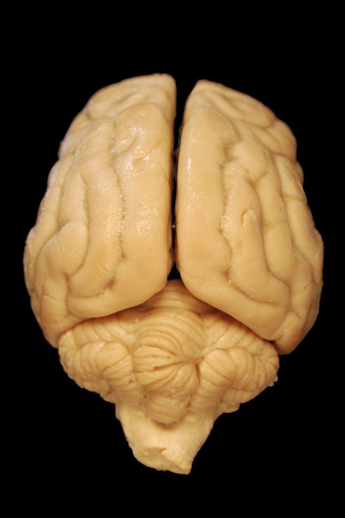 Smegenys, Anatomija, Šuo, Biologija, Nugaros Dalis, Kūnas, Veterinarinė Medicina, Galvos Smegenys, Smegenėlė, Mokslas