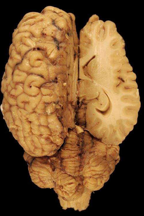 Smegenys, Anatomija, Arklys, Biologija, Nugaros Dalis, Kūnas, Veterinarinė Medicina, Galvos Smegenys, Smegenėlė, Pusrutulis, Skersinis Pjūvis, Mokslas
