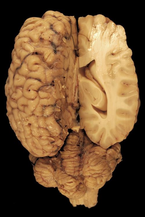Smegenys, Anatomija, Akys, Paerparat, Arklys, Biologija, Nugaros Dalis, Kūnas, Veterinarinė Medicina, Galvos Smegenys, Smegenėlė, Skilvelis, Skersinis Pjūvis, Baltoji Medžiaga, Pilka Medžiaga, Mokslas