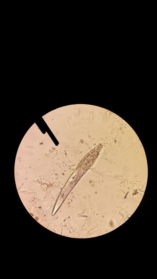 Demodex, Mikroskopas, Odos Erkė