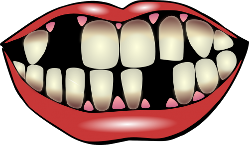 Dantų Higiena, Dantų Priežiūra, Nukristi Iš Dantų, Dantų Sveikata, Burna, Dantys, Dantis, Nemokama Vektorinė Grafika