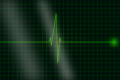 Elektrokardiogramma, Ecg, Širdies Plakimas, Dažnumas, Impulsas, Banga, Kompiuterinė Grafika, Signalas, Nemokama Vektorinė Grafika