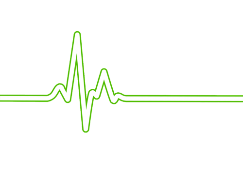 Širdies Ritmas, Bpm, Ecg, Ekg, Elektrokardiogramma, Ecg Bangos, Stebėti, Širdis, Sveikata, Gyvenimas, Impulsas