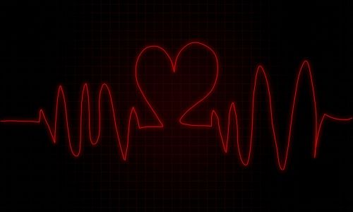 Stebėti, Širdis, Mušti, Širdies Plakimas, Širdies Plakimas, Kardio, Sveikata, Medicinos, Impulsas, Kardiologija, Sveika Širdis, Grafas, Norma, Klinika, Dažnumas, Ligoninė