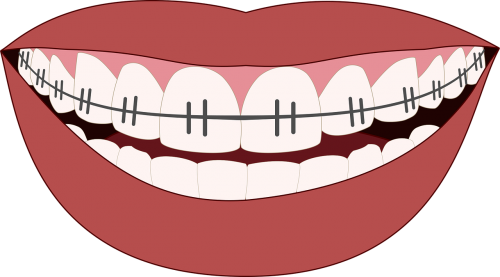 Ortodontija, Šypsena, Dantys, Stomatologas, Odontologija, Šypsosi, Dantų Burna, Prietaisas, Piktograma, Iliustracija, Nemokama Vektorinė Grafika