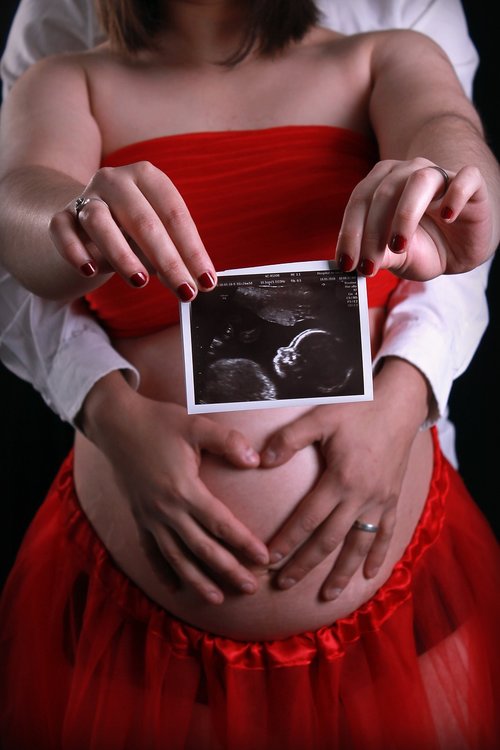 Nėštumas,  Ultragarso,  Nėščia,  Vertinimas,  Moterys,  Motina,  Fotografijos,  Motinystės,  Kūdikių,  Vaikas,  Dukra,  Mergina,  Mama,  Šeima,  Tėvai