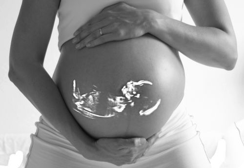 Nėščia, Kūdikis, Echo, Ultragarsu, Nėštumas, Pilvas, Šeima, Tikisi, Motina, Moteris, Vaisius