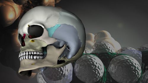 Kaukolė, Galva, 3D Modelis, Atvaizdavimas, Medicinos, Virtualus, Atstovavimas, Žmogaus Anatomija, Kaukolės Kaulai, Kaukolė Ir Skersmens Kaulai, Kaulas, Skeletas, Žmogus