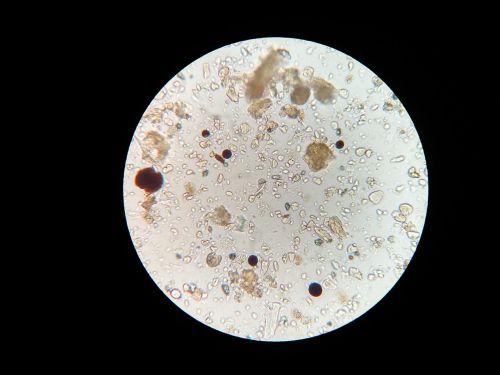 Dirvožemio Mikrobai, Mikroskopas, Dirvožemio Pavyzdys
