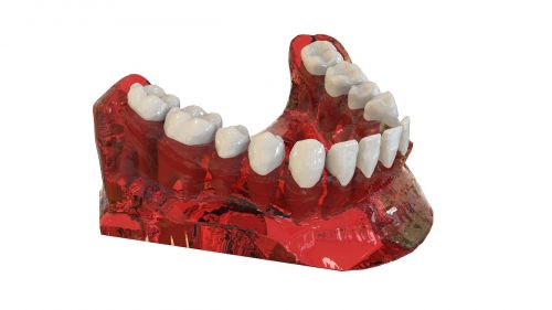 Dantys, Žandikaulis, 3D Modelis, Ortodontija, Implantas