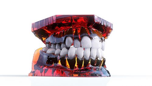 Dantys, Žandikaulis, 3D Modelis, Ortodontija, Odontologija